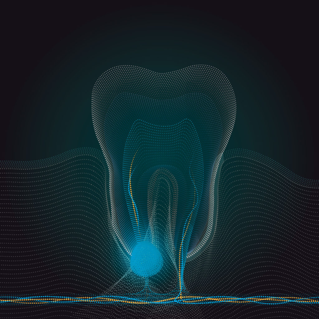 apicoectomy color