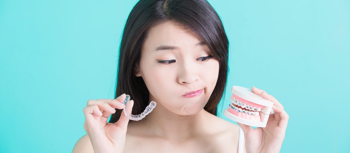 InvisalignⓇ Common Asked Questions